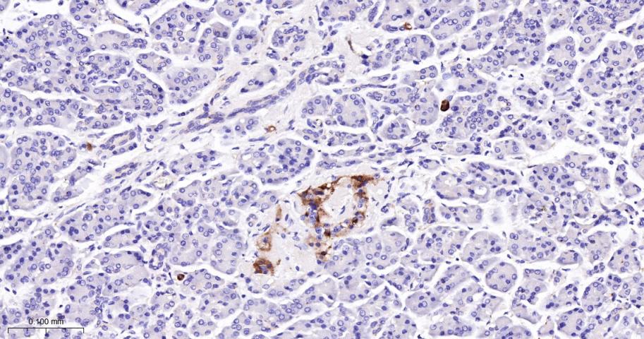 朊病毒蛋白CD230重组兔单抗