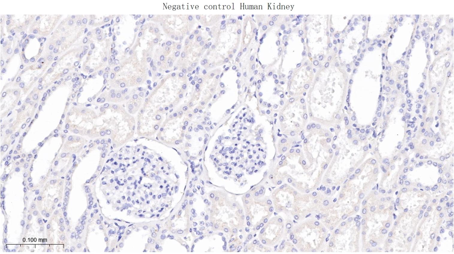 酪氨酸激酶A/B/C重组兔单抗-bsm-52715R