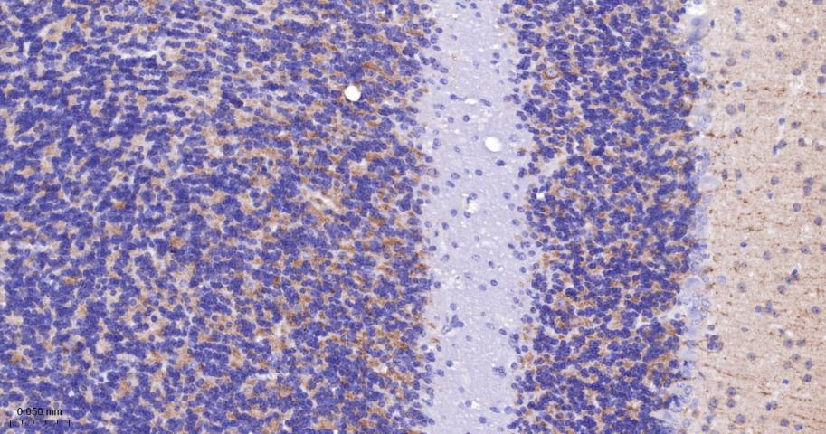 酪氨酸激酶A/B/C重组兔单抗-bsm-52715R