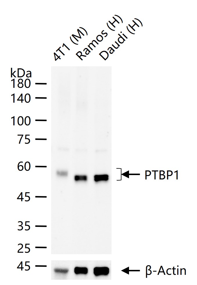 核糖核酸结合蛋白1重组兔单抗-bsm-60550R