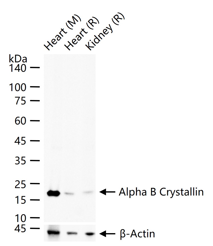 Alpha B Crystallin Recombinant Rabbit mAb (一抗) - WB,IHC-P,IHC-F,IF,ICC/IF,IP | Bioss