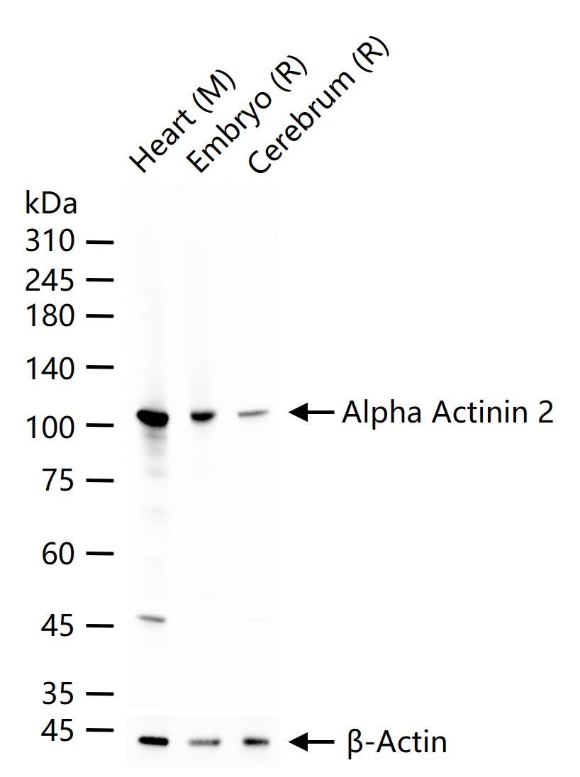 α横纹肌辅肌动蛋白重组兔单克隆抗体