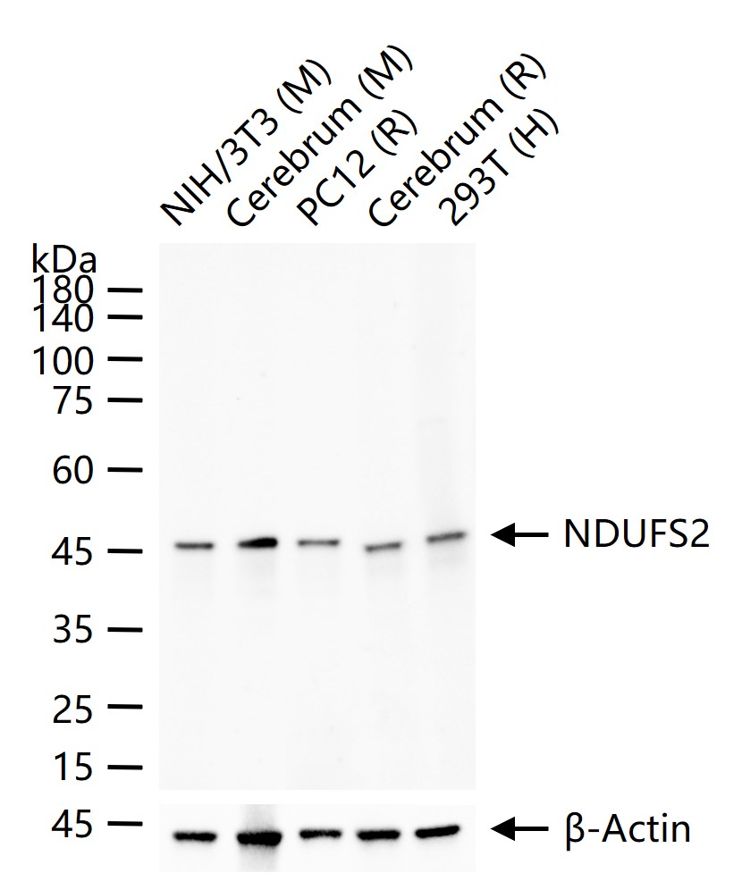 NDUFS2重组兔单抗