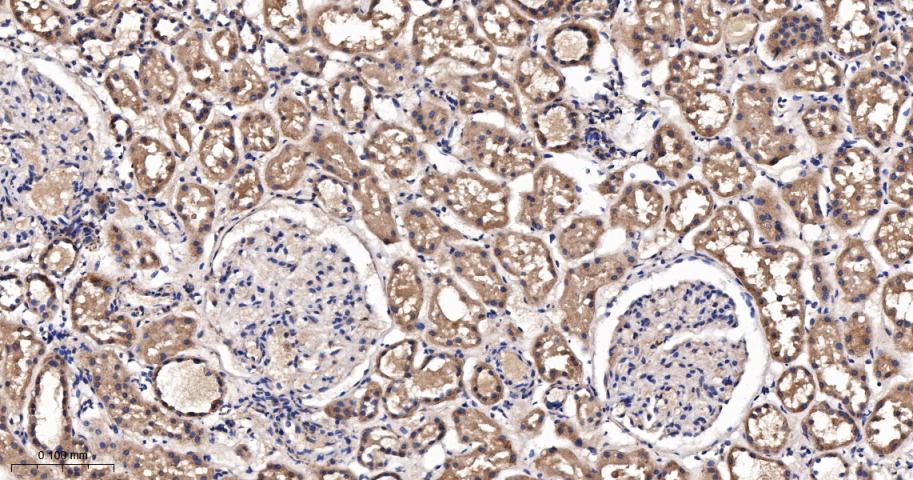 Runx3重组兔单抗