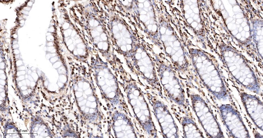 组蛋白H2AZ重组兔单抗