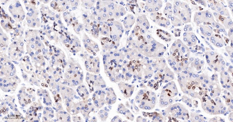 胰岛素促进因子重组兔单抗
