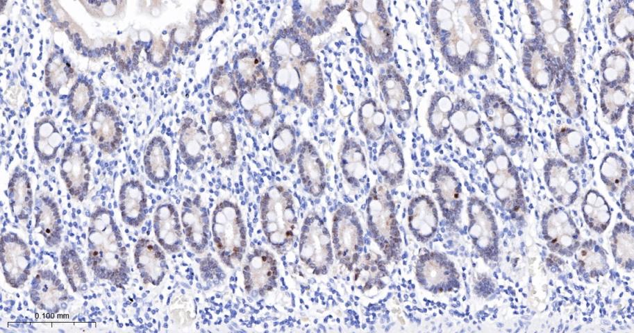 胰岛素促进因子重组兔单抗