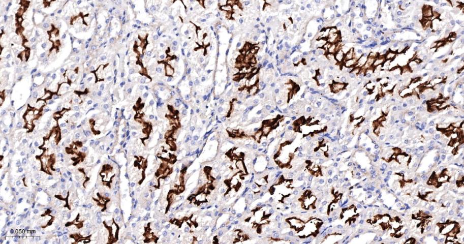 促代谢型谷氨酸受体1重组兔单抗