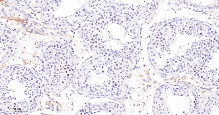 周期素E2重组兔单抗
