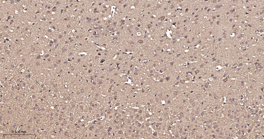 热休克蛋白56重组兔单抗