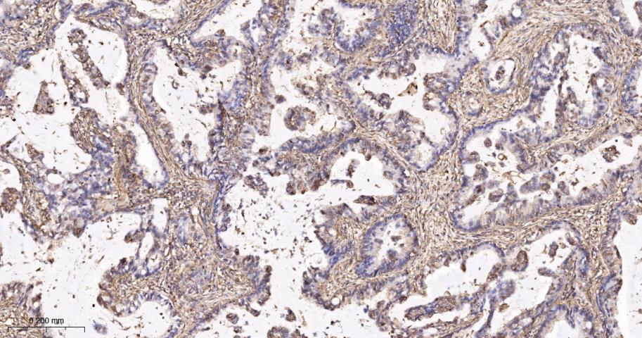 β-肌动蛋白/β-Actin（内参）重组兔单抗