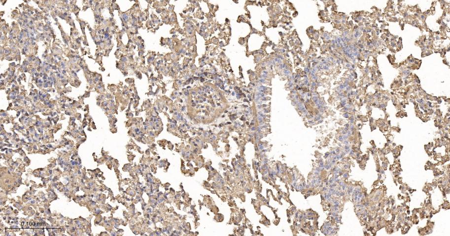 β-肌动蛋白/β-Actin（内参）重组兔单抗