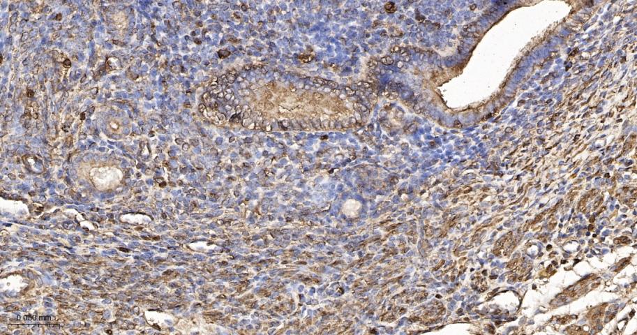 β-肌动蛋白/β-Actin（内参）重组兔单抗