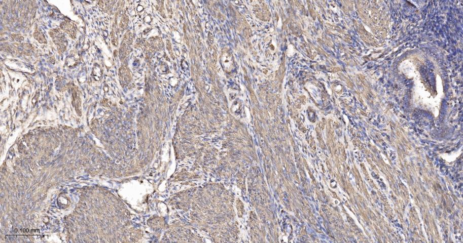 β-肌动蛋白/β-Actin（内参）重组兔单抗
