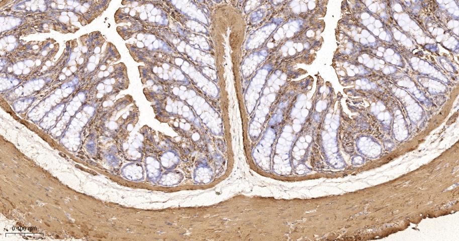 β-肌动蛋白/β-Actin（内参）重组兔单抗