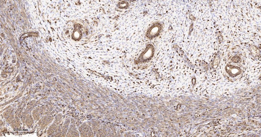 β-肌动蛋白/β-Actin（内参）重组兔单抗