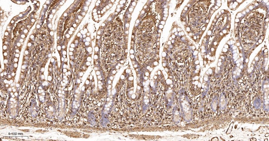 β-肌动蛋白/β-Actin（内参）重组兔单抗