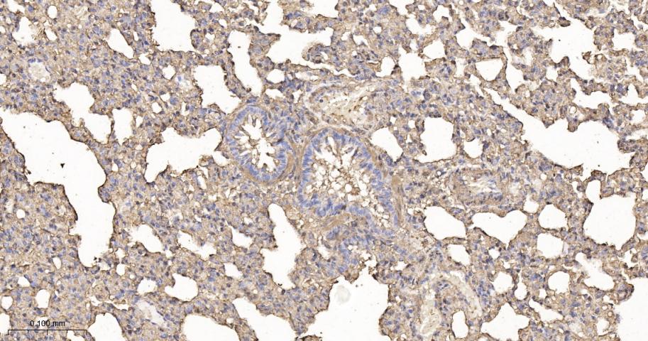 β-肌动蛋白/β-Actin（内参）重组兔单抗