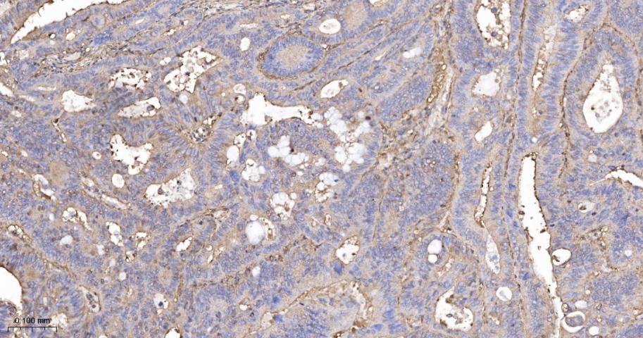 β-肌动蛋白/β-Actin（内参）重组兔单抗