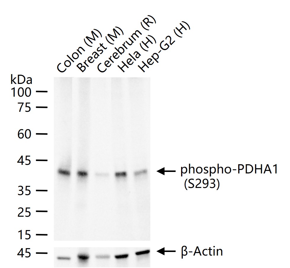 磷酸化丙酮酸脱氢酶α1重组兔单抗