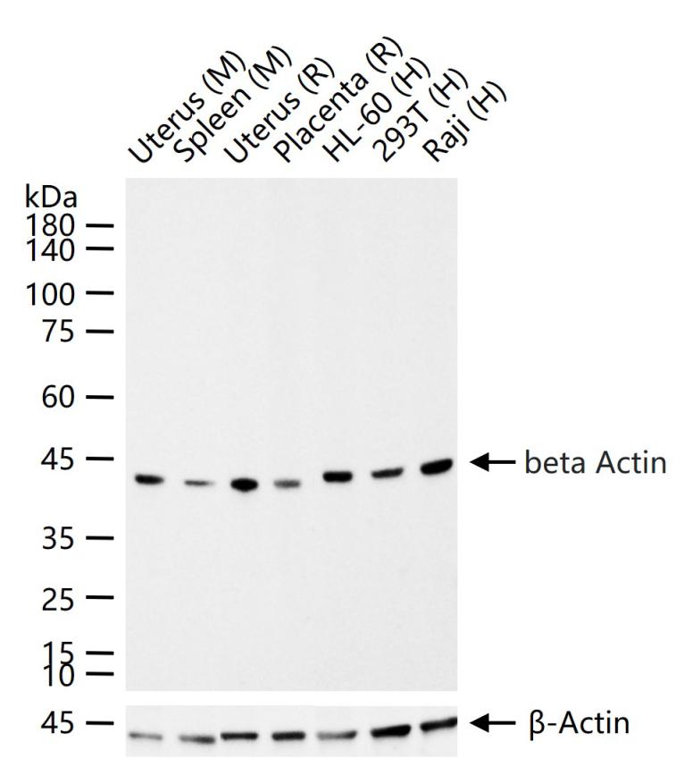 β-肌动蛋白/β-Actin（内参）重组兔单抗