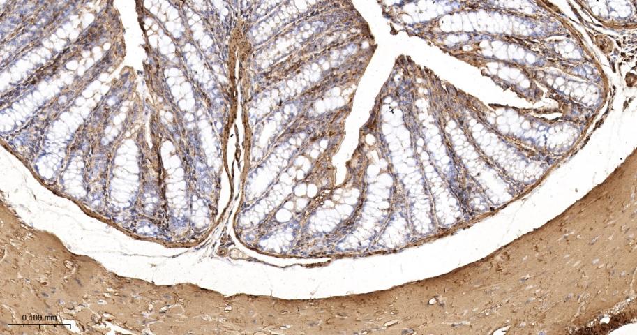 β-肌动蛋白/β-Actin（内参）重组兔单抗