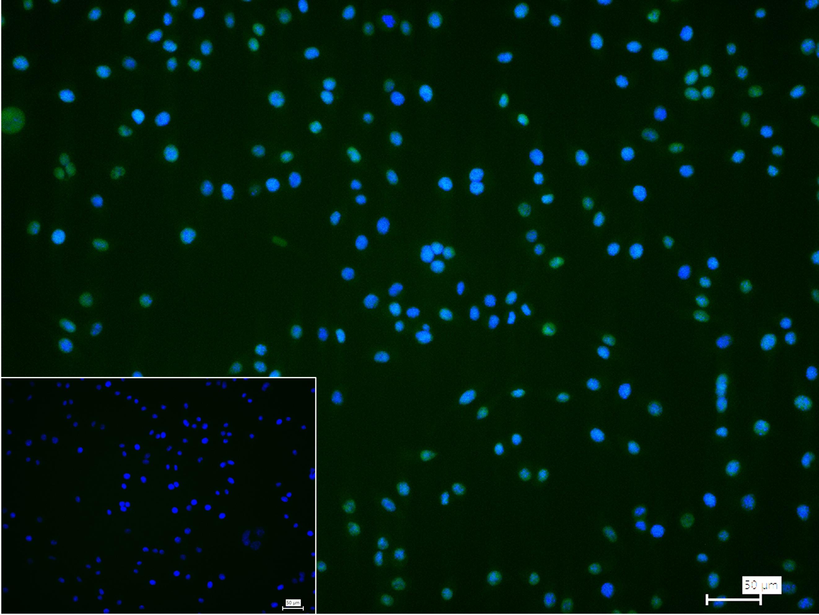 神经干细胞RNA结合蛋白Musashi1重组兔单抗