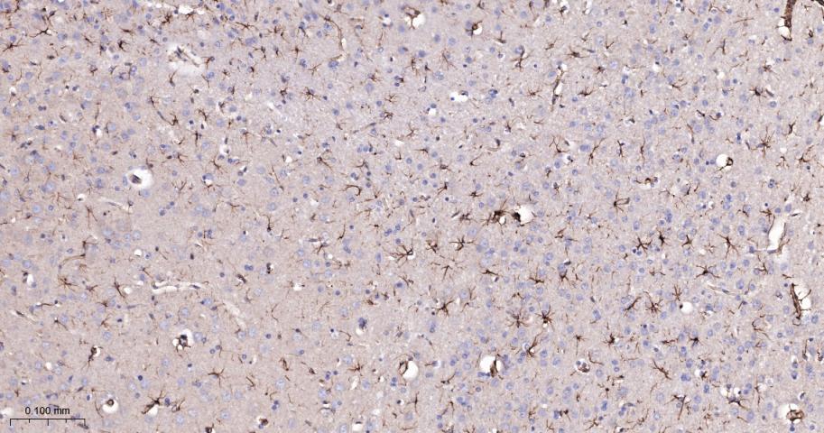 桩蛋白Paxillin重组兔单抗