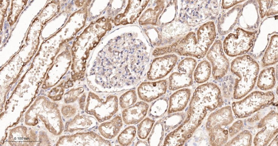 磷酸羧化酶2重组兔单抗