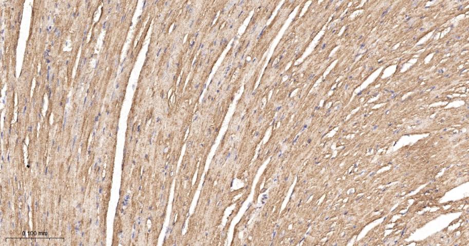磷酸羧化酶2重组兔单抗