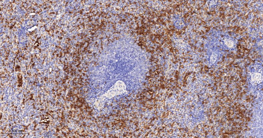 Band3 Recombinant Rabbit mAb (一抗) - IHC-P,IHC-F,IF | Bioss