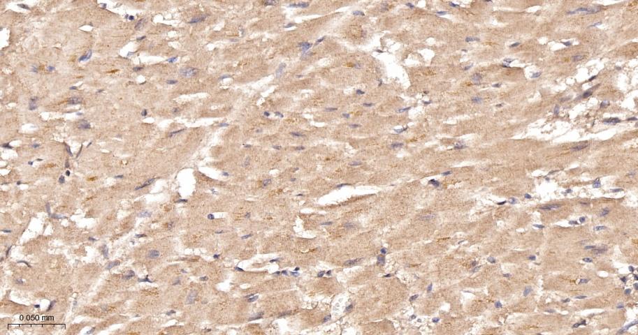 磷酸羧化酶2重组兔单抗