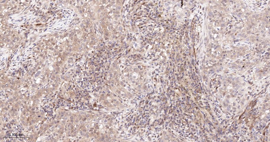 半胱胺酸蛋白酶-7重组兔单抗