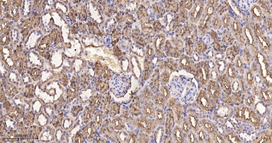 磷酸羧化酶2重组兔单抗