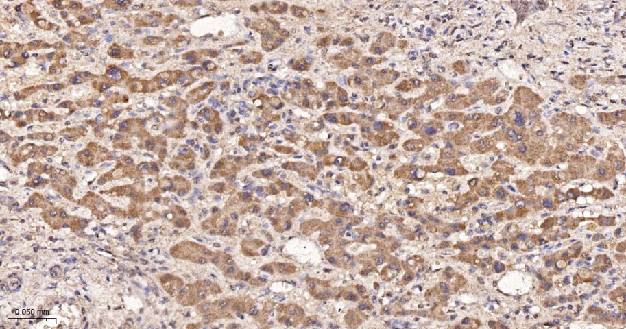 磷酸羧化酶2重组兔单抗