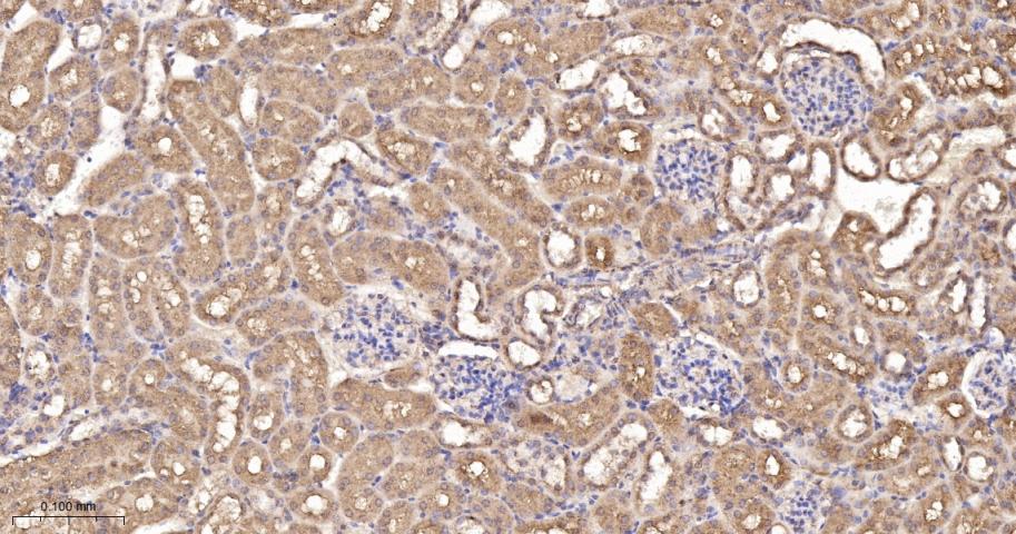 磷酸羧化酶2重组兔单抗