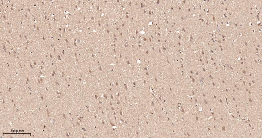 磷酸羧化酶2重组兔单抗