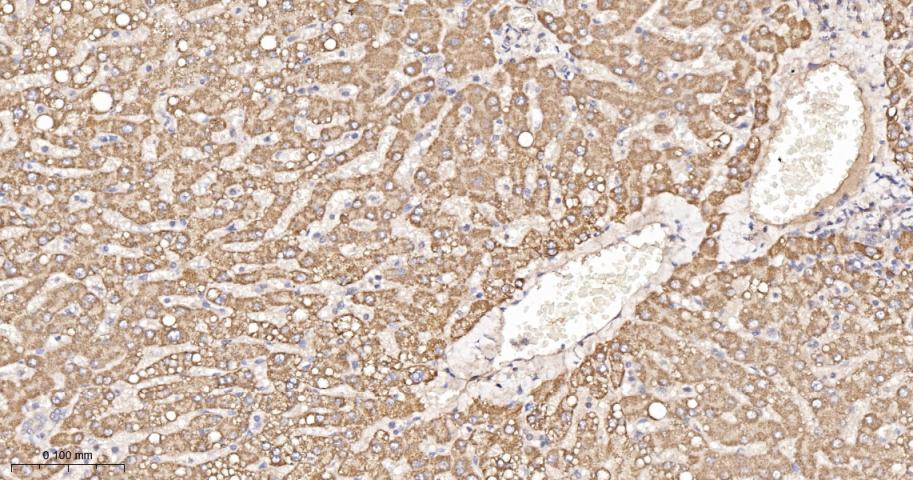 磷酸羧化酶2重组兔单抗