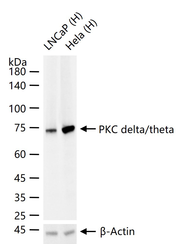 蛋白激酶C-δ/θ重组兔单抗