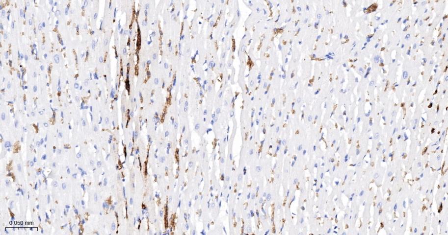 血红蛋白α1/α-Globin重组兔单抗-bsm-60287R