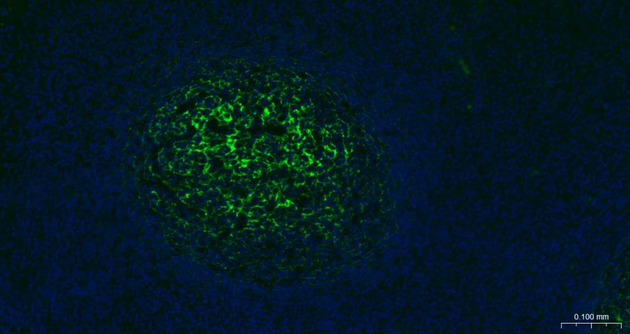 Ⅰ型补体受体重组兔单抗