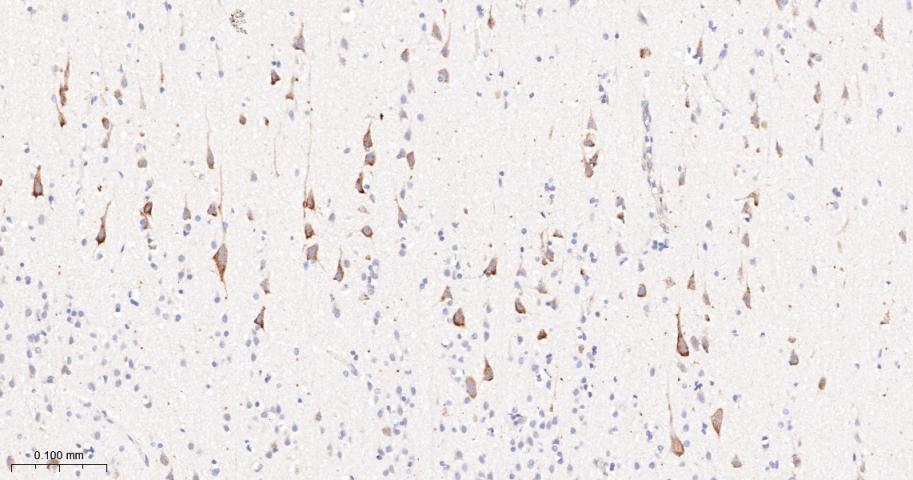 磷酸化叉头蛋白3A重组兔单抗