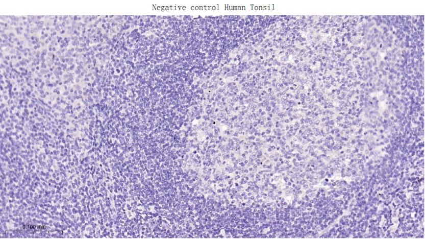 雌激素受体α重组兔单克隆抗体