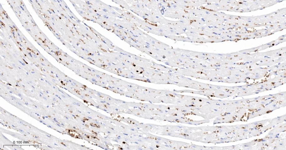 血红蛋白α1/α-Globin重组兔单抗-bsm-60287R