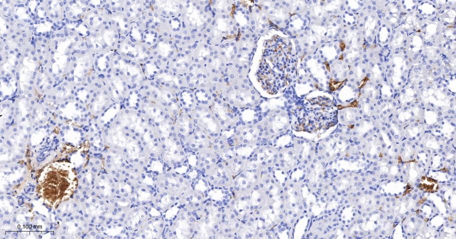 血红蛋白α1/α-Globin重组兔单抗-bsm-60287R