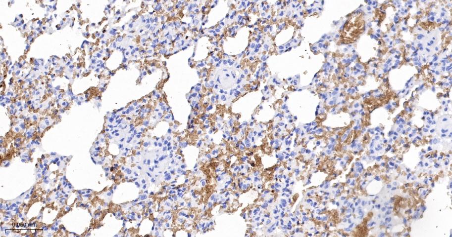 血红蛋白α1/α-Globin重组兔单抗-bsm-60287R