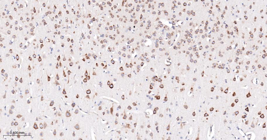 磷酸化叉头蛋白3A重组兔单抗