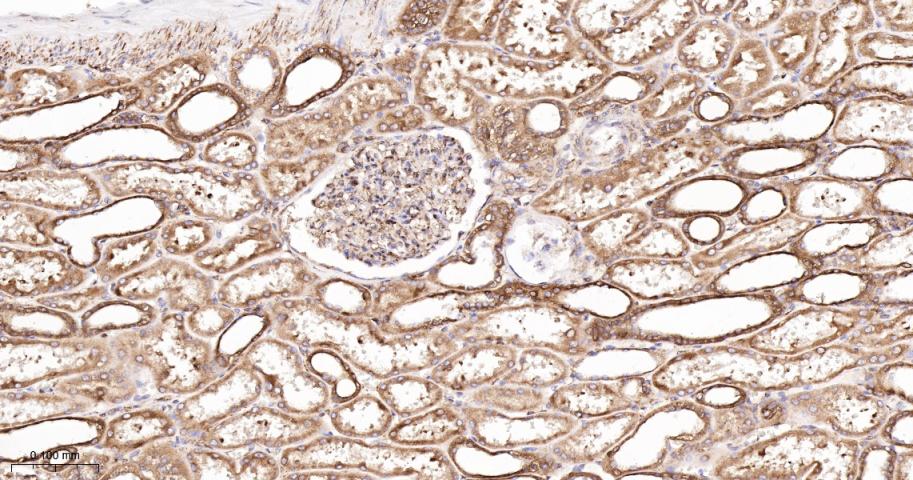 钙连蛋白重组兔单抗