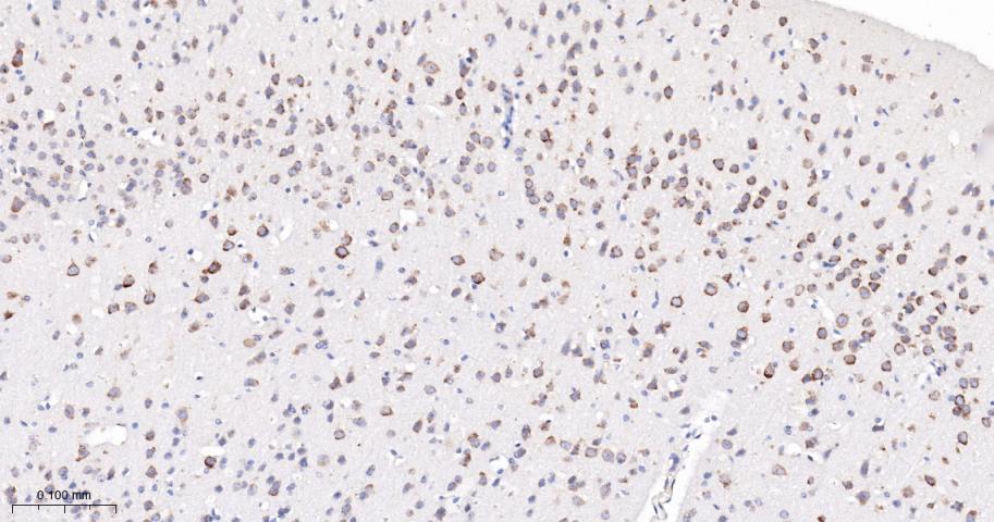 磷酸化叉头蛋白3A重组兔单抗
