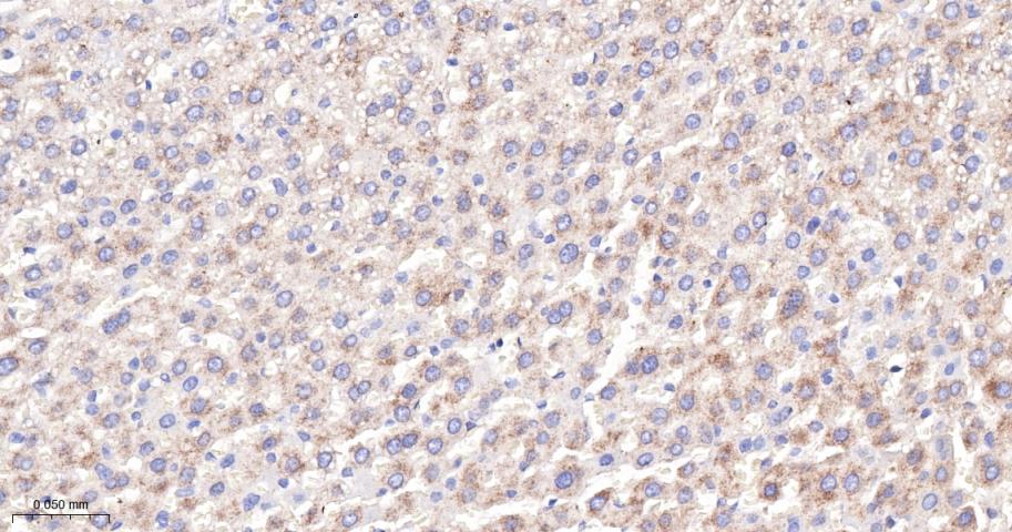 磷酸化叉头蛋白3A重组兔单抗
